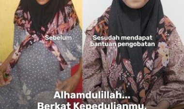 Alhamdulillah Berkat Kepedulianmu, Ibu Rikah Sembuh dari Asites