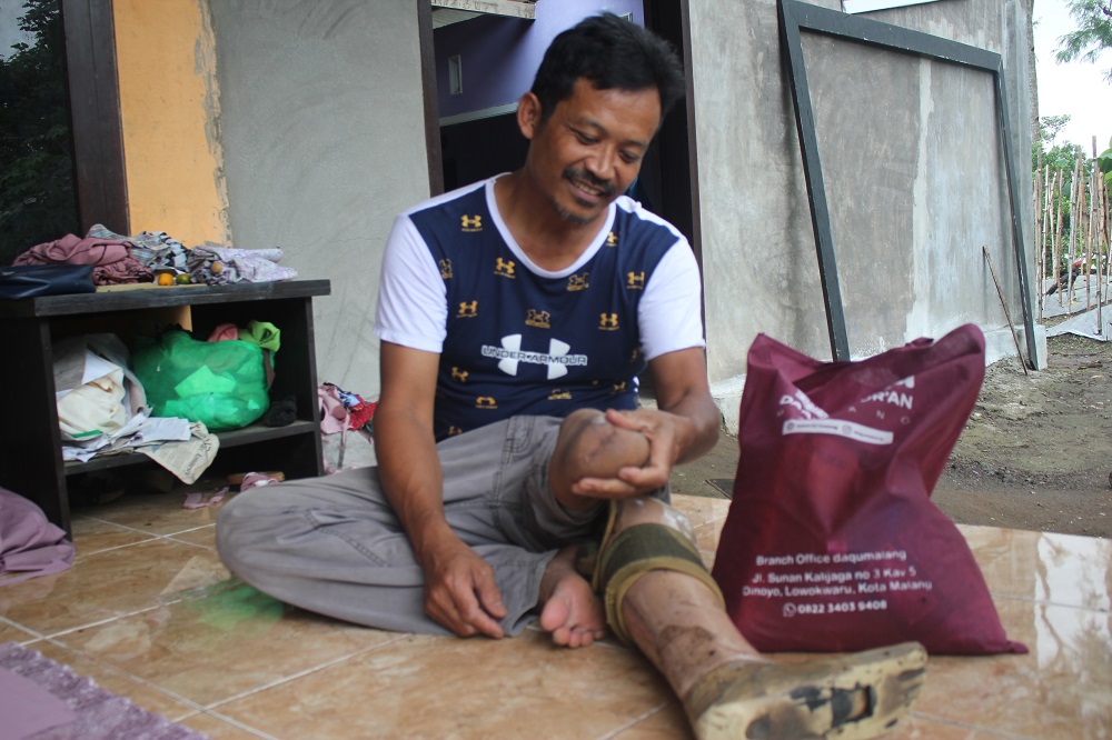 Kakinya Diamputasi, Sueb Tetap Semangat Nafkahi Keluarga